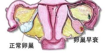 重视卵巢储备功能减退，干细胞疗法提高生育力